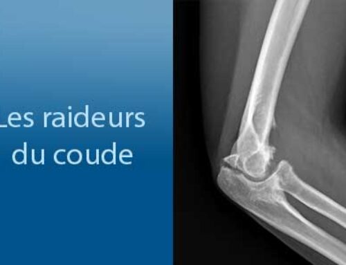 Les raideurs du coude