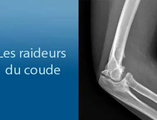 Les raideurs du coude