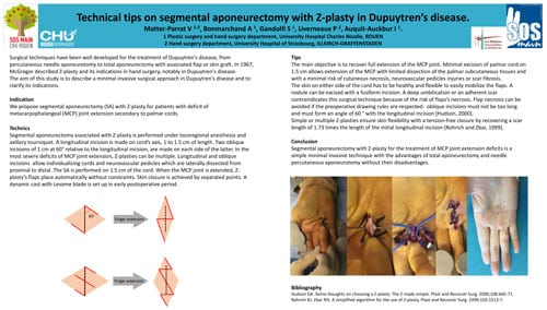 Dupuytren-poster