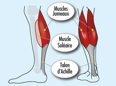 La rétraction des muscles gastrocnémiens - IM2S