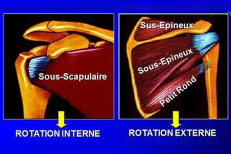 Epaule – tendon – coiffe des rotateurs