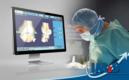 chirurgie-assistee-ordinateur Chirurgie assistée par ordinateur dans les prothèses totales du genou