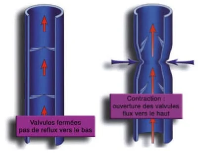 varices