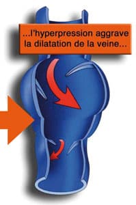 Veines apparentes grossesse Veines apparentes grossesse