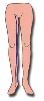 veine-saphene varices-01