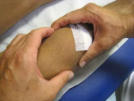 reeducation-ligamentoplastie-genou La rééducation des ligamentoplasties du genou