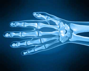 Main – Infection de la main et des doigts