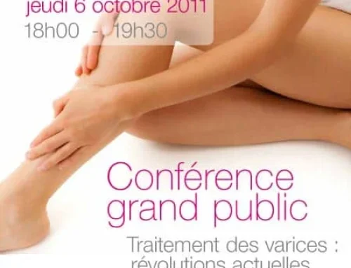 Conférence grand public – Traitement des varices