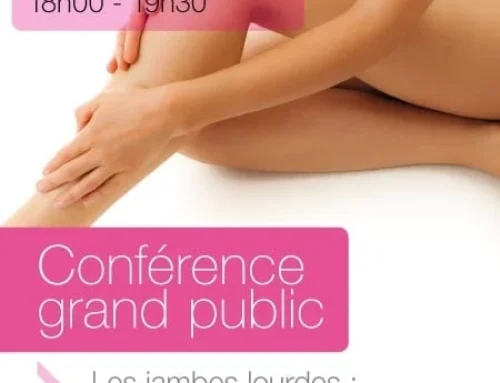 Conférence grand public – Les jambes lourdes