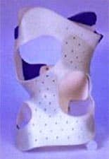scoliose-enfant-corset-CTM scoliose-enfant-corset-CTM