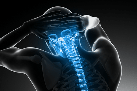 Corporectomie / fusion antérieure