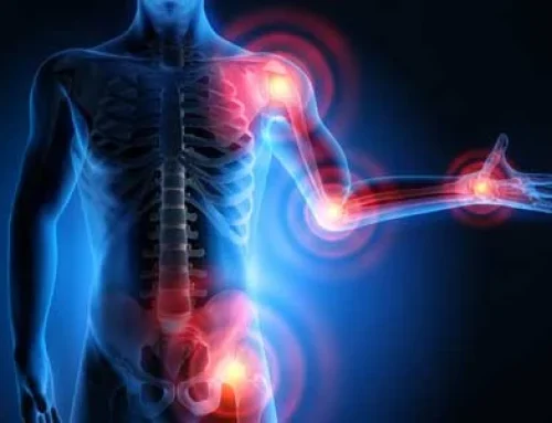 Pour que l&rsquo;arthrose ne soit plus une fatalité