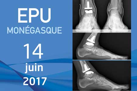 epu-monaco-juin-2017