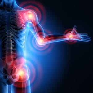 arthrose-rhumatologie chirurgie de l'épaule