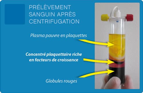 facteurs-de-croissance facteurs-de-croissance