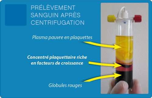 facteurs-de-croissance