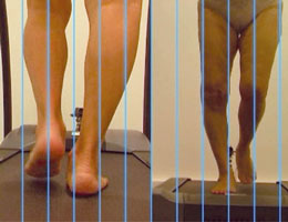 Analyse au ralenti des mouvements des pieds et de tout le membre inférieur par un système de caméras vidéo