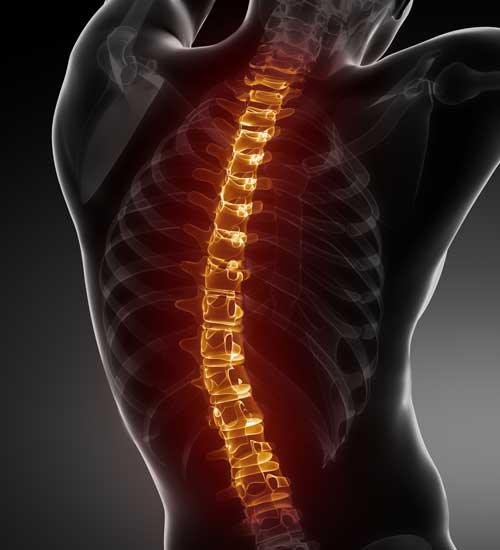 Le mal de dos : Groupes à risques, causes, symptômes et diagnostic ...