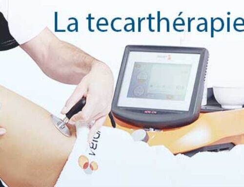 La tecarthérapie, une prise en charge innovante de la douleur