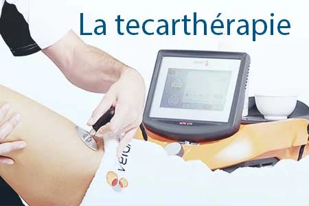 thumb-tecartherapie La tecarthérapie, une prise en charge innovante de la douleur