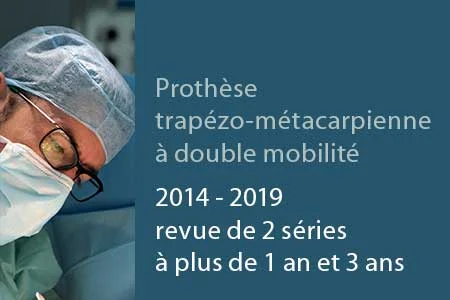 Prothèse trapézo-métacarpienne à double mobilité : revue de 2 séries à plus de 1 an et 3 ans