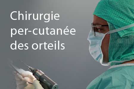 thumb-chirurgie-orteils