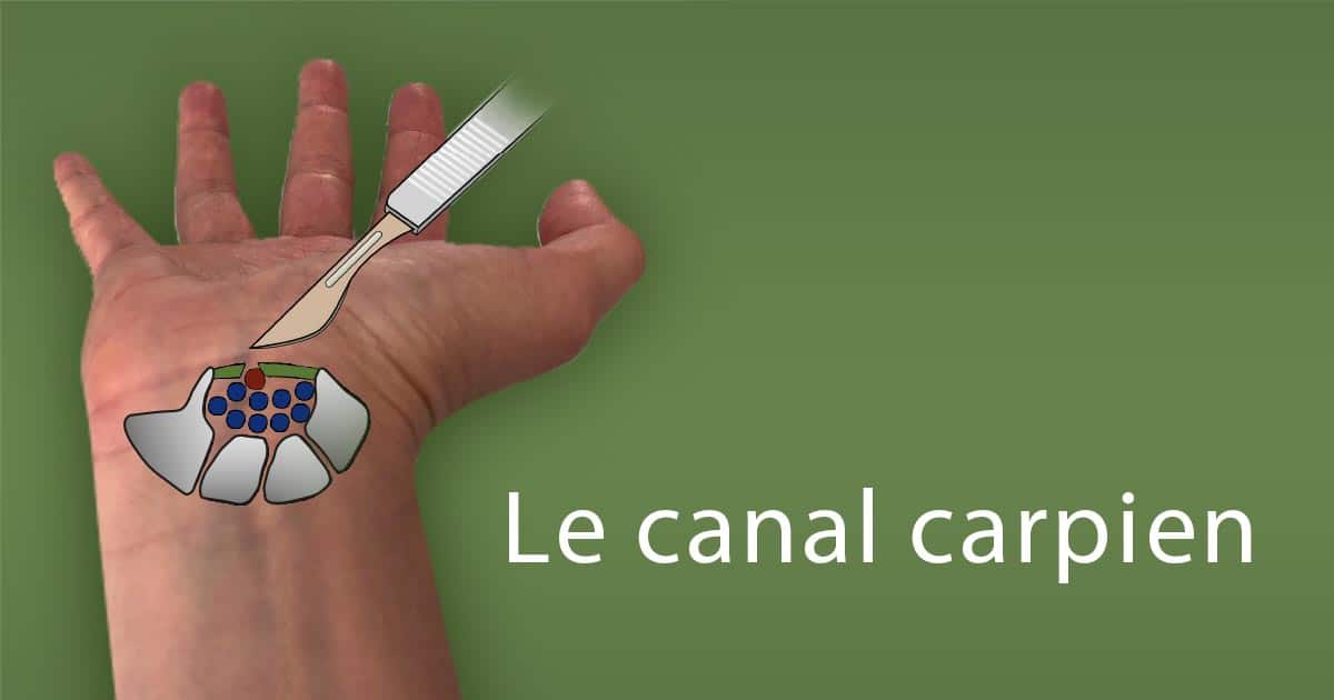 Clinique De La Main Nantes Canal Carpien