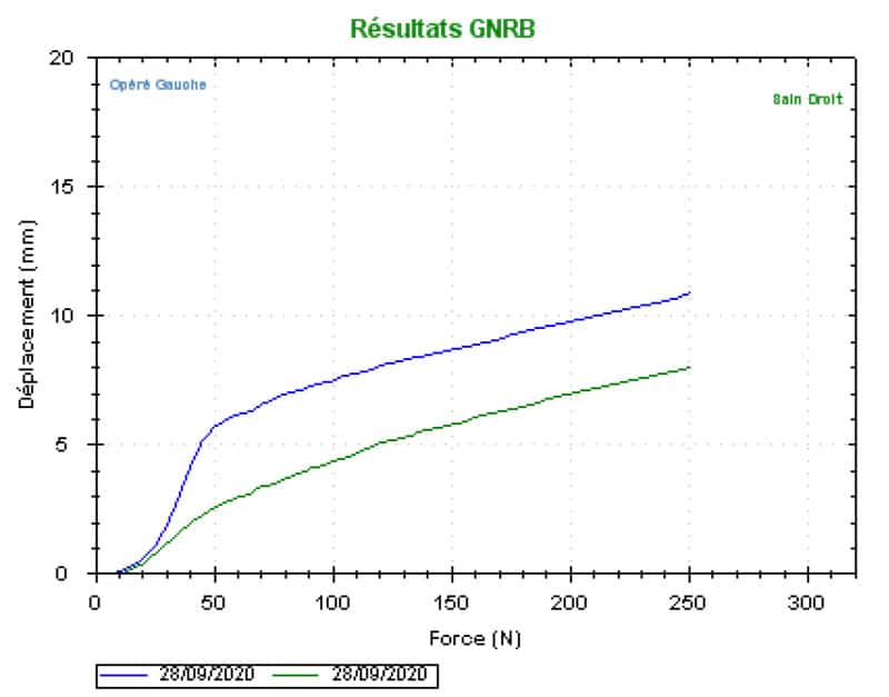 GNRB-laximetrie-dynamique-automatisee_test-de-lachman-courbe