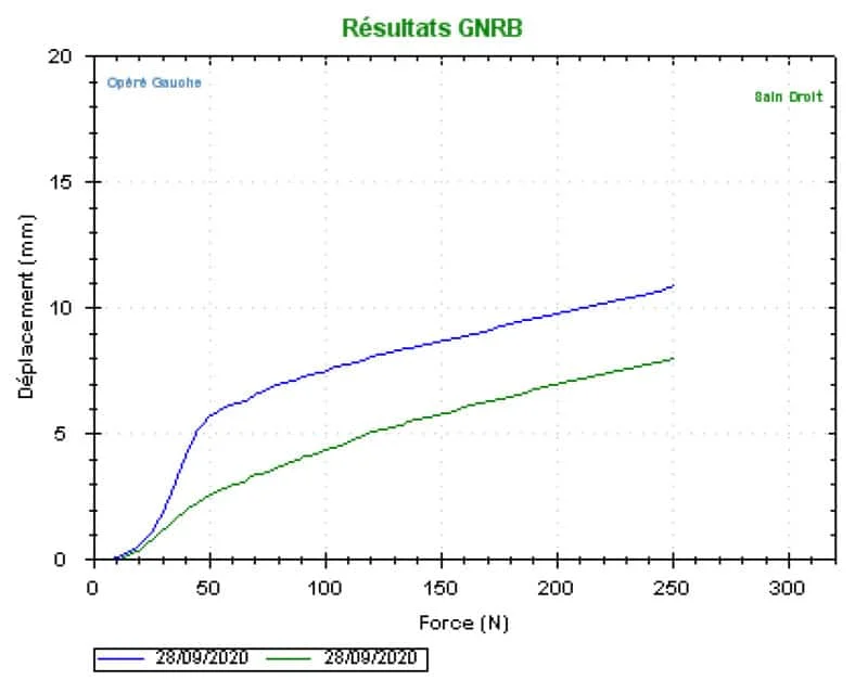 GNRB-laximetrie-dynamique-automatisee_test-de-lachman-courbe