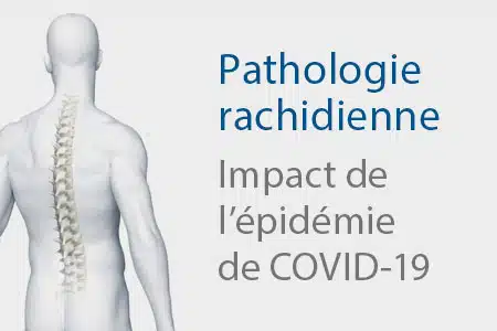 thumb-rachis-covid