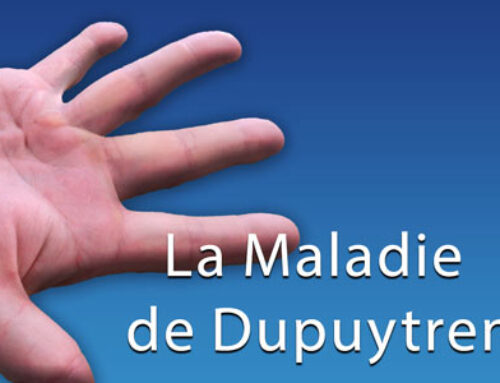 La Maladie de Dupuytren