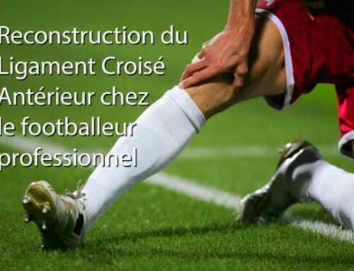 Reconstruction du Ligament Croisé Antérieur chez le footballeur professionnel