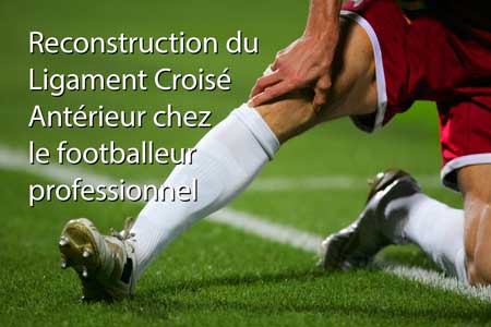 Reconstruction du Ligament Croisé Antérieur chez le footballeur professionnel