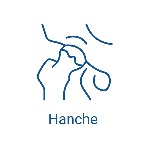 chirurgie de la hanche Monaco Nice 06 PACA