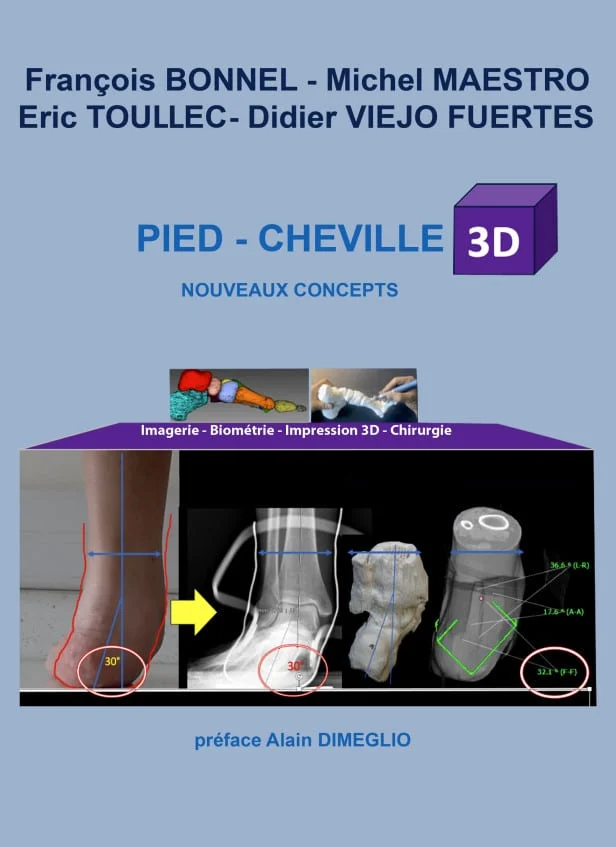 pied-et-cheville-3d-nouveaux-concepts 20963