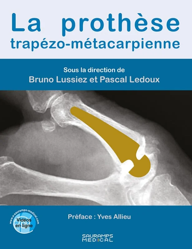 ptothese-trapezo-metacaprienne 20963
