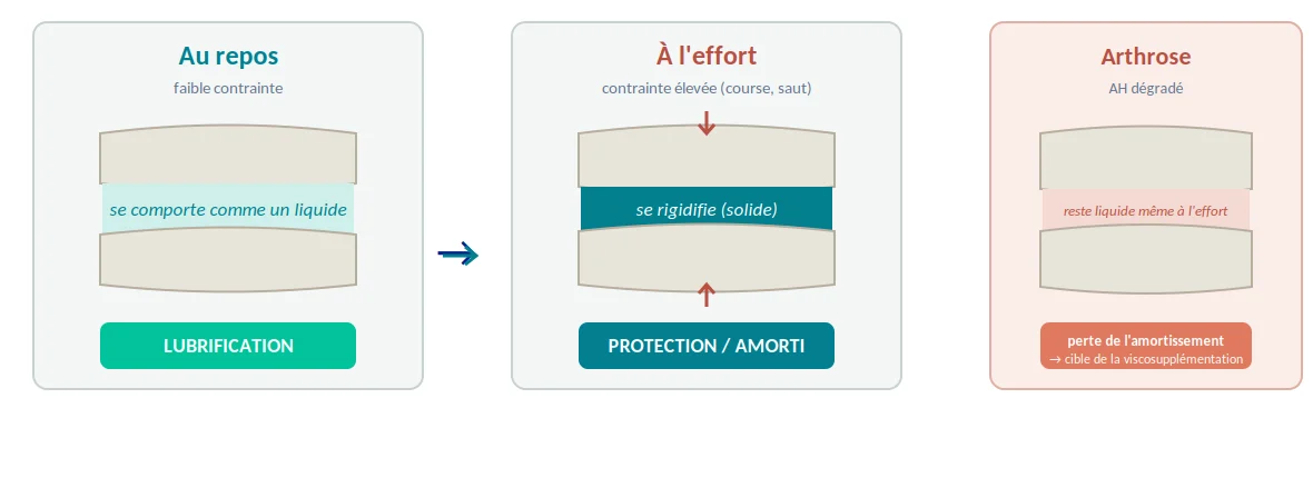 Les injections dans l’arthrose du genou