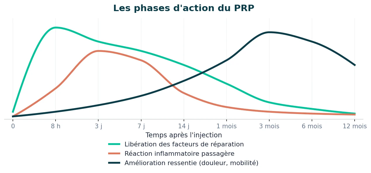 Les injections dans l’arthrose du genou