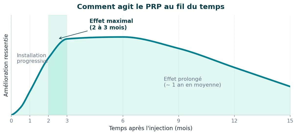 Les injections dans l’arthrose du genou